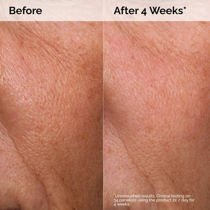 سرم آبرسان هیالورونیک اسید 2% + B5 اوردینری حجم 30 میلی لیتر